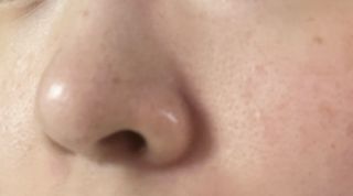 세뚜아(Cettua) 세뚜아 스티키 포어 패치 Cettua Sticky Pore Patch — 5점을 준 리뷰어가 2023년 8월 올린 사용 사진