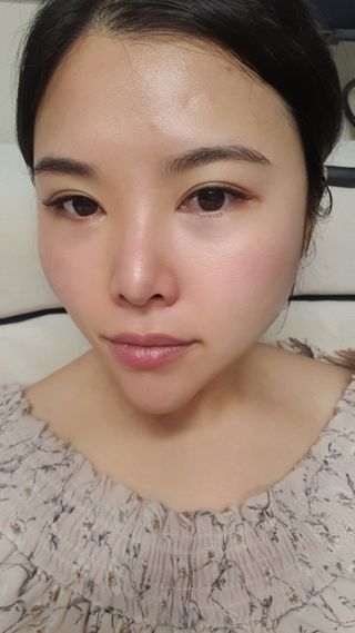 바이리뮤 에이지 홀딩 펩타톡스 앰플 — 5점을 준 리뷰어가 2021년 1월 올린 사용 사진