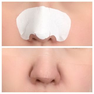 세뚜아(Cettua) 세뚜아 스티키 포어 패치 Cettua Sticky Pore Patch — 4점을 준 리뷰어가 2023년 6월 올린 사용 사진