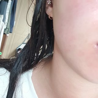 코드네이처 비아미 시카 더블 앰플 과 마스크[5장] — 2.5점을 준 리뷰어가 2021년 8월 올린 사용 사진