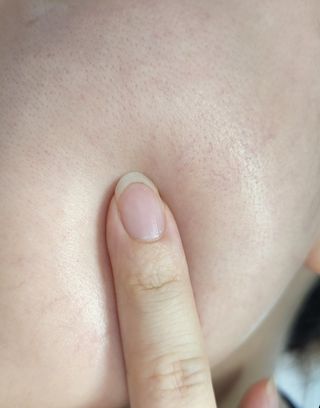 베지톨로지 비니페린 워터 에센스 — 5점을 준 리뷰어가 2022년 7월 올린 사용 사진