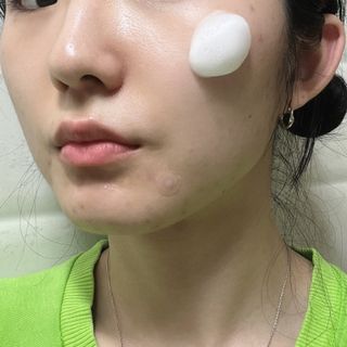 [아셀라 원킬] 멜라 화이트 크림+프로텍션 썬 BB — 4점을 준 리뷰어가 2022년 3월 올린 사용 사진