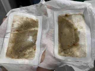 [레제르] 아로마 수액패치 발패치 30매입 -라벤더향/유칼립투스향/대나무향 — 3.5점을 준 리뷰어가 2022년 5월 올린 사용 사진