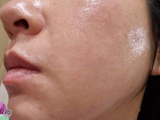 난나 살몬 스파이더 검버섯 미백 톤업 화이트닝 연어 앰플 크림 300ml 대용량 — 5점을 준 리뷰어가 2022년 8월 올린 사용 사진