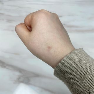히루스카 포스트아크네 클리어 — 5점을 준 리뷰어가 2021년 2월 올린 사용 사진