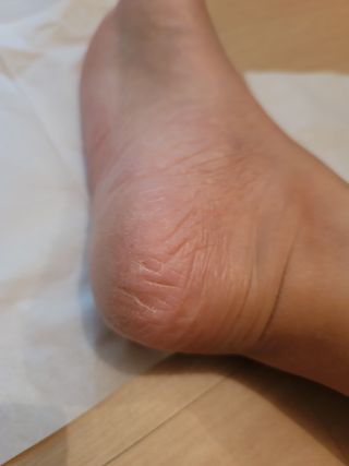 임단미님이 올린 리뷰 사진 4