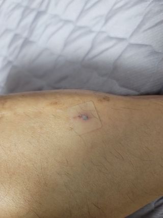 [큐어반H 커팅] 간편하게 떼서 쓰는 자외선차단 습윤밴드 (1팩/30매입) — 5점을 준 리뷰어가 2022년 11월 올린 사용 사진