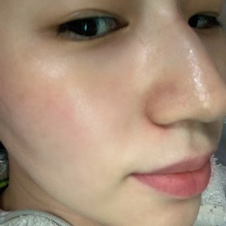 에이스노 레스큐 이미디에이트 수딩 시트마스크 — 4.5점을 준 리뷰어가 2021년 10월 올린 사용 사진