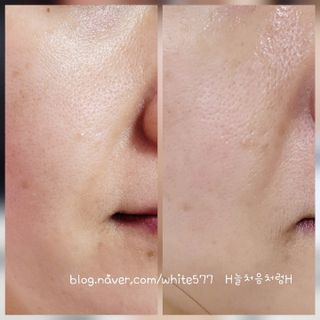 H늘처음처럼H님이 올린 리뷰 사진 1