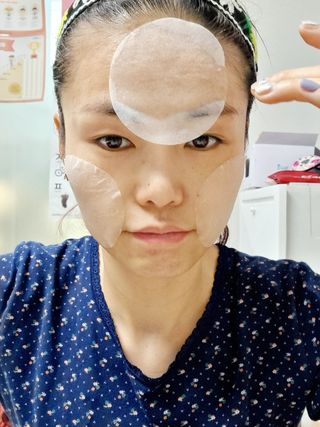 랑벨 랑바이오 블랙 시카 퀵 패드 100매 (3초 쿨링/3분 흡수, 블랙비 프로폴리스/시카 4종 함유, 대용량) — 5점을 준 리뷰어가 2022년 3월 올린 사용 사진