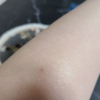 히루스카 포스트아크네 클리어 — 5점을 준 리뷰어가 2021년 2월 올린 사용 사진