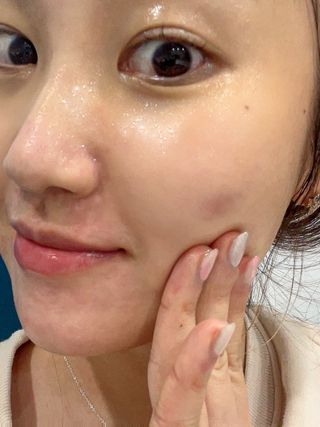 체르엠 그린 케비어 더블워터 마스크팩 5매입  2팩 — 5점을 준 리뷰어가 2021년 12월 올린 사용 사진