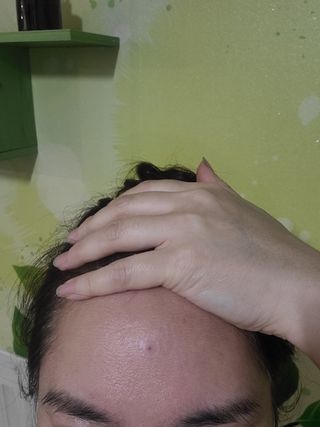 [큐어반H 스팟] 자외선 99프로 차단되는 스틱타입 스팟밴드(1팩 / 66매입) — 5점을 준 리뷰어가 2022년 11월 올린 사용 사진