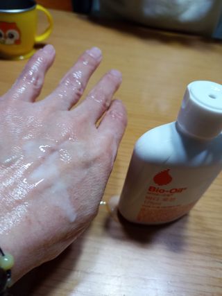 바이오오일 [바이오-오일] 바디 로션 175ml — 5점을 준 리뷰어가 2021년 12월 올린 사용 사진