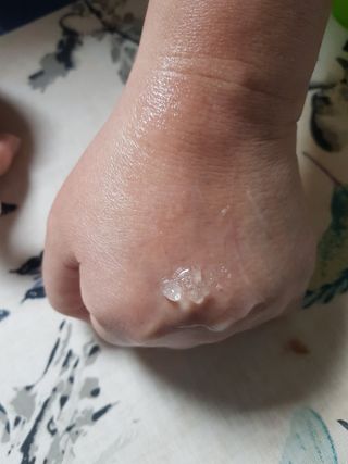 레드투래드 센서티브 어메이징 앰플 30ml — 5점을 준 리뷰어가 2021년 6월 올린 사용 사진