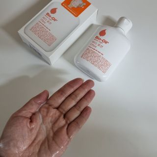 바이오오일 [바이오-오일] 바디 로션 175ml — 5점을 준 리뷰어가 2021년 11월 올린 사용 사진
