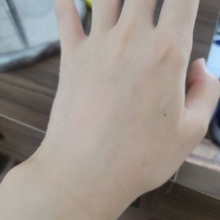 키노닉스 원더 레미디 튜브 보습크림 — 5점을 준 리뷰어가 2021년 9월 올린 사용 사진
