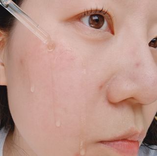 MF[스킨1004] 마다가스카르 센텔라 앰플 100ml — 5점을 준 리뷰어가 2024년 5월 올린 사용 사진