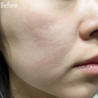[베르비아떼] 소나무의 강인한 생명력으로 시간을 되돌리는 힘 레드파인 3종 세트 (토너, 에센스, 크림) — 5점을 준 리뷰어가 2023년 6월 올린 사용 사진