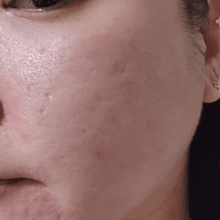 [녹산] 그린 솔루션 멀티 수분 앰플 + 그린 솔루션 멀티 수분크림 — 5점을 준 리뷰어가 2022년 10월 올린 사용 사진