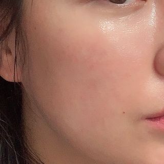 엘리샤코이 콤부차 결바이옴 앰플 — 5점을 준 리뷰어가 2022년 2월 올린 사용 사진