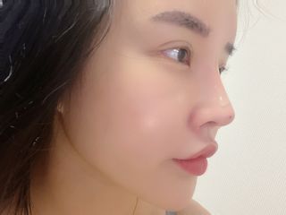 체르엠 스템앤셀 비타민 브라이트닝 에센스 30ml 1개 — 4.5점을 준 리뷰어가 2021년 10월 올린 사용 사진
