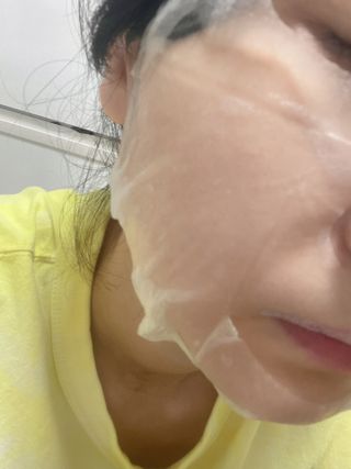 세뚜아(Cettua) 세뚜아 스팟 클리어 듀얼 패치 Cettua Spot Clear Dual Patch — 5점을 준 리뷰어가 2023년 9월 올린 사용 사진