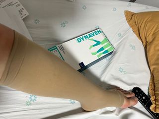 시그바리스 다이나벤 의료용 압박 스타킹 [종아리형] 여름철 다리 붓기 관리 하지정맥류 예방 — 5점을 준 리뷰어가 2024년 6월 올린 사용 사진