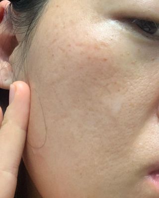 리더스코스메틱 리더스 카밍 바이오틱스 에센스 워터 — 5점을 준 리뷰어가 2021년 12월 올린 사용 사진