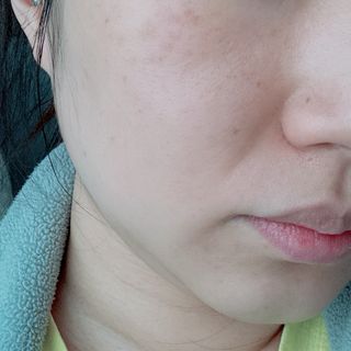 하이브리온 [구매평]닥터초이스 갈락토미 프로바이오틱 세범케어 올인원 로션 1개, 100ml — 5점을 준 리뷰어가 2025년 8월 올린 사용 사진