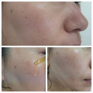코매료 셀인키 리바이탈 퍼펙트 세럼 2종(천연오일100프로+순수비타민c150,000ppm) — 4.5점을 준 리뷰어가 2024년 2월 올린 사용 사진