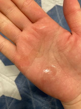 mom e 맘이 내추럴 베이비 케어 크림+바디오일 — 3.5점을 준 리뷰어가 2021년 1월 올린 사용 사진