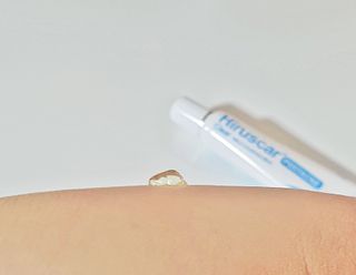 히루스카 포스트아크네 클리어 — 5점을 준 리뷰어가 2020년 12월 올린 사용 사진