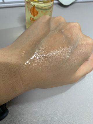 바이오오일 [바이오-오일] 스킨케어 오일 내추럴 60ml — 4점을 준 리뷰어가 2021년 6월 올린 사용 사진