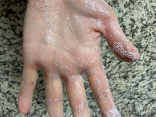 제이제이바이오 허브마사지바 올인원 알약비누 — 5점을 준 리뷰어가 2021년 11월 올린 사용 사진