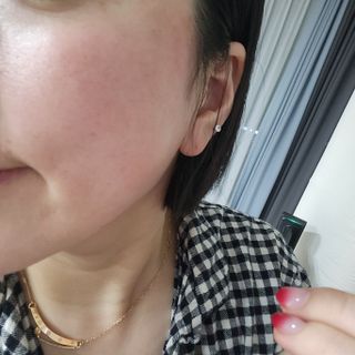 [팜스테이] 티트리 바이옴 카밍 세럼 — 5점을 준 리뷰어가 2023년 1월 올린 사용 사진