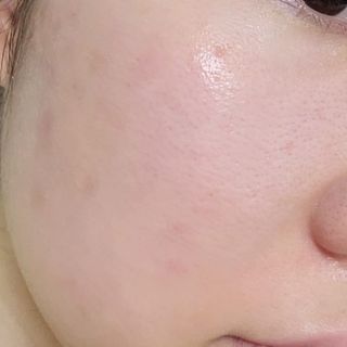 비니비니님이 올린 리뷰 사진 3
