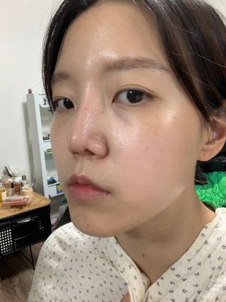 [스킨1004] 마다가스카르 센텔라 앰플 100ml — 5점을 준 리뷰어가 2024년 5월 올린 사용 사진