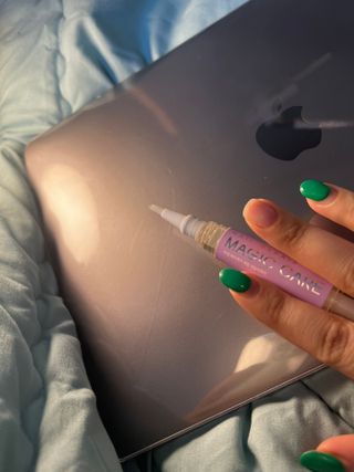 뷰젤 매직케어 네일솔루션 손발톱 보습 영양제 펜슬타입 5ml — 5점을 준 리뷰어가 2022년 3월 올린 사용 사진