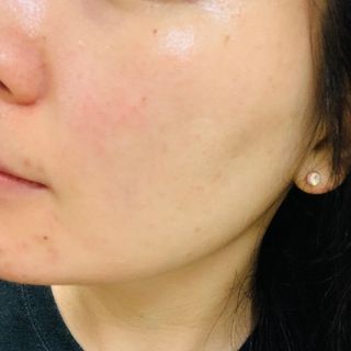 리더스코스메틱 리더스 카밍 바이오틱스 에센스 워터 — 5점을 준 리뷰어가 2021년 6월 올린 사용 사진