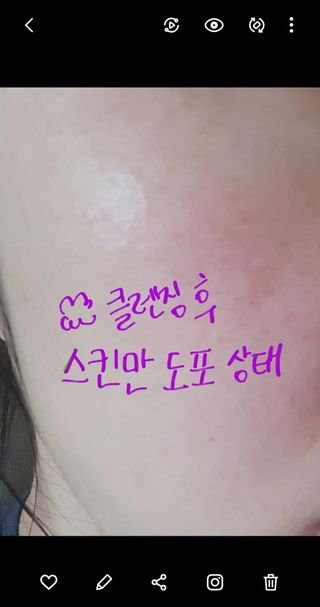 바베 BABE 바베 프로테오글리칸 F+F 앰플 솔루션 — 4점을 준 리뷰어가 2021년 1월 올린 사용 사진