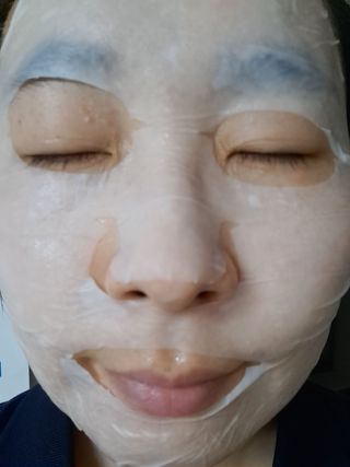 세뚜아(Cettua) 세뚜아 스팟 클리어 듀얼 패치 Cettua Spot Clear Dual Patch — 5점을 준 리뷰어가 2023년 6월 올린 사용 사진