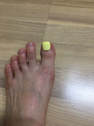 틸디앤 에어플렉스 젤리핏 페디팁 — 5점을 준 리뷰어가 2021년 7월 올린 사용 사진