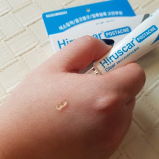 히루스카 포스트아크네 클리어 — 4.5점을 준 리뷰어가 2021년 2월 올린 사용 사진