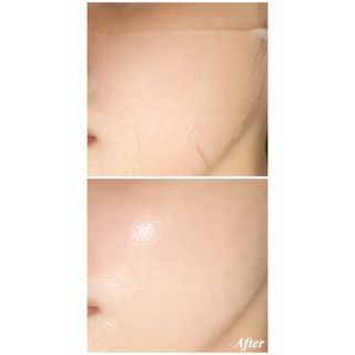 리더스코스메틱 리더스 아임피토 마스크 6종 — 5점을 준 리뷰어가 2021년 10월 올린 사용 사진