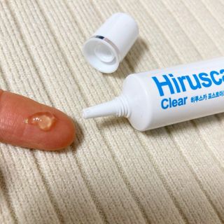 히루스카 포스트아크네 클리어 — 5점을 준 리뷰어가 2021년 2월 올린 사용 사진