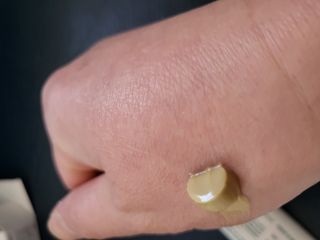 건선/아토/습진/민감성 피부 천연보습진정크림 소리온 크림 & 센시티브 크림 50g — 5점을 준 리뷰어가 2022년 1월 올린 사용 사진