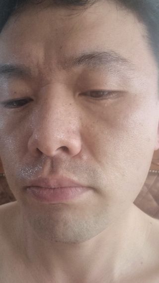 셀바이져 지우개 미스트 피부 보호 입주변 트러블 진정 케어 아기 안개분사 미스트 — 4.5점을 준 리뷰어가 2021년 3월 올린 사용 사진