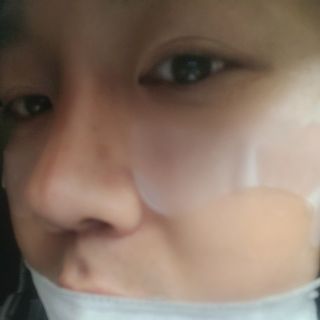 원에이드 알로에사포나리아 투명 골프패치 & 원에이드 하이드로겔 스포츠패치 — 5점을 준 리뷰어가 2022년 8월 올린 사용 사진