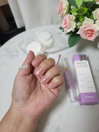 1+2 뷰젤 매직케어 손톱영양제+스톤푸셔+코인타올 셀프 네일케어 — 5점을 준 리뷰어가 2022년 10월 올린 사용 사진